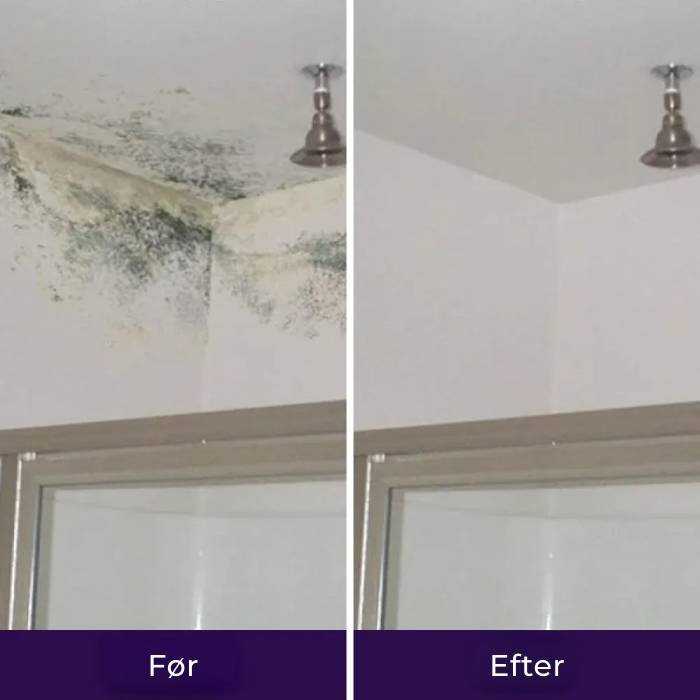 NuroClean image