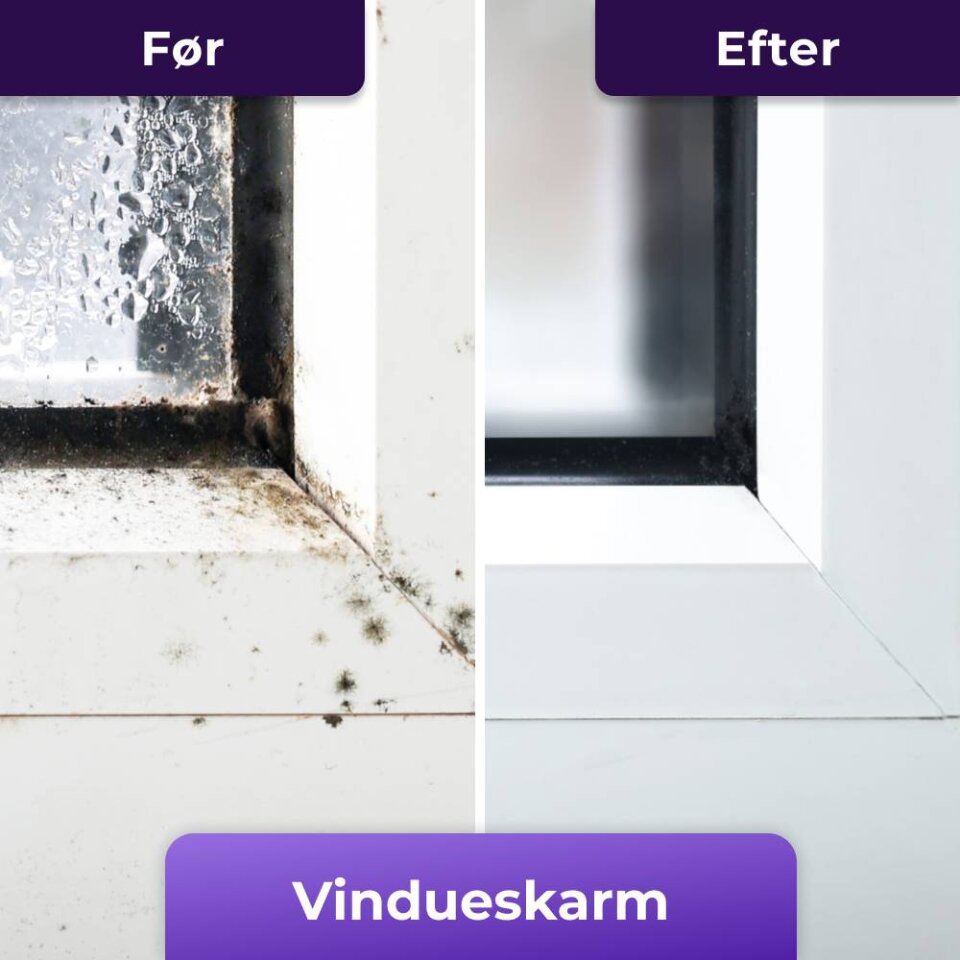 NuroClean image
