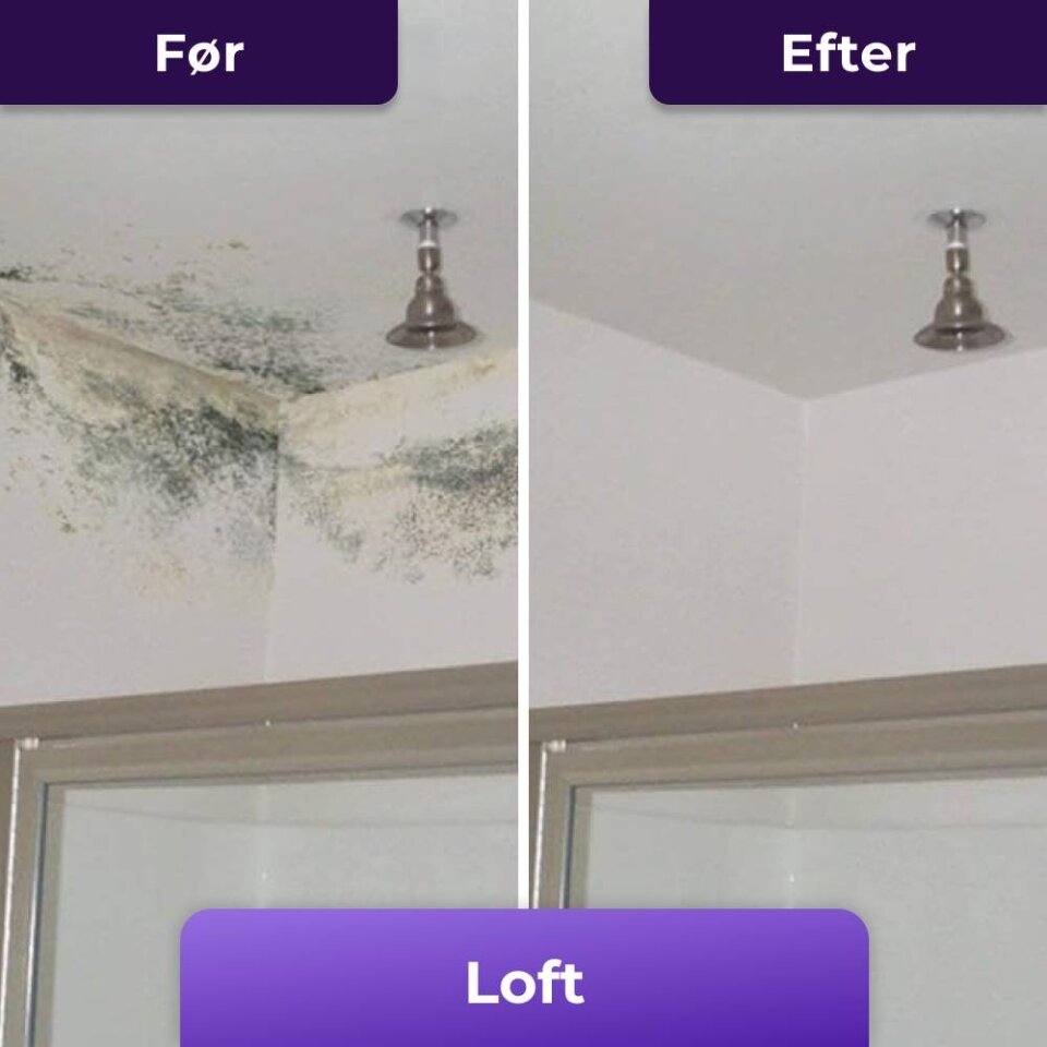 NuroClean image
